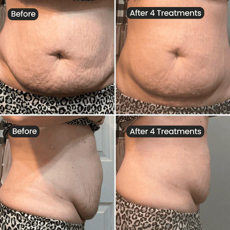 Testimonial voor SHOCKIN RESULTS