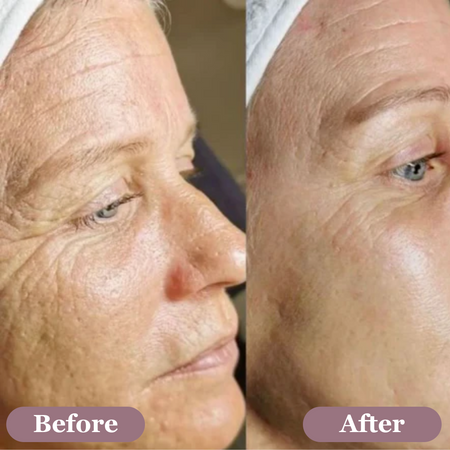 Testimonial voor Crows Feet