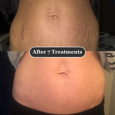 Testimonial voor Wonderful Fading Results