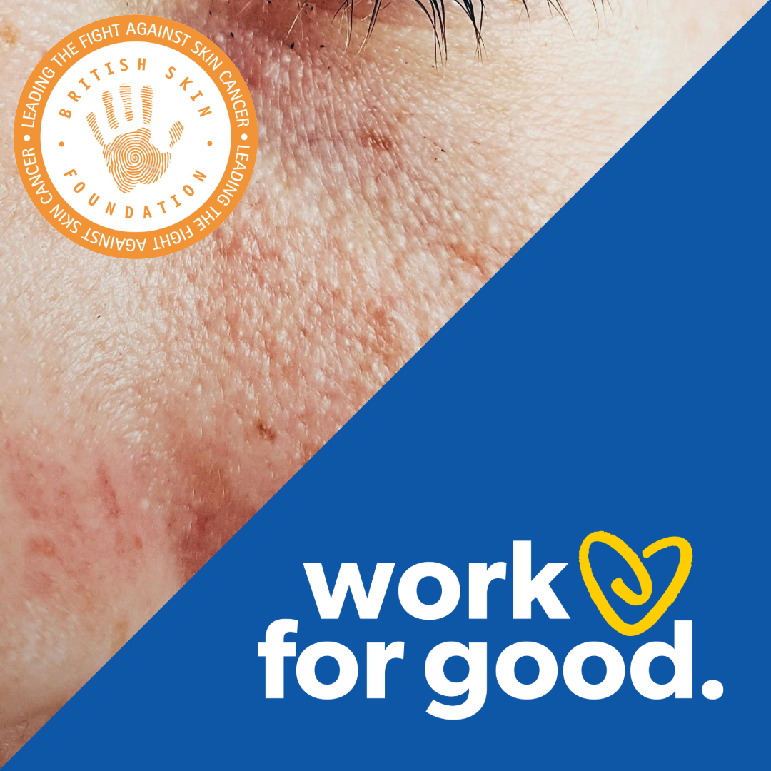 Together For Skin Research