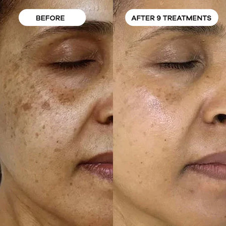 Testimonial voor Dark Spots & Age Spots