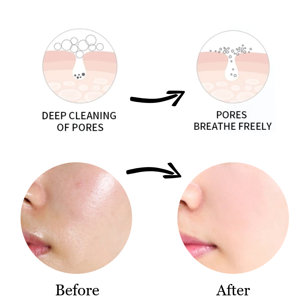 Facial Foam Cleanser (PH Neutral)