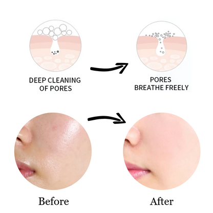 Facial Foam Cleanser (PH Neutral)